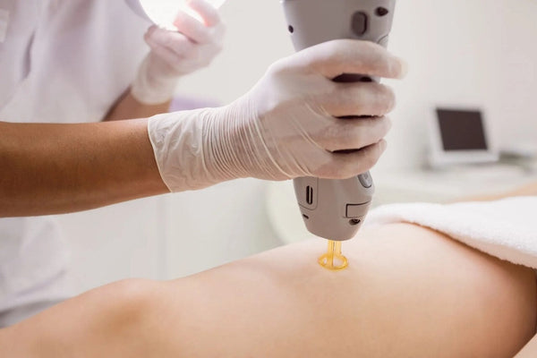 Full Body Laser Hair Removal – 6 Sessions vividderma 